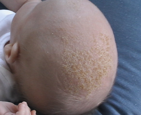 Baby Skin Care: Safe Skincare for Newborns, Babies & Children - What You Need to Know