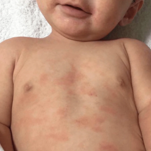 Baby Skin Care: Safe Skincare for Newborns, Babies & Children - What You Need to Know