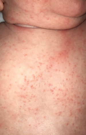 Baby Skin Care: Safe Skincare for Newborns, Babies & Children - What You Need to Know