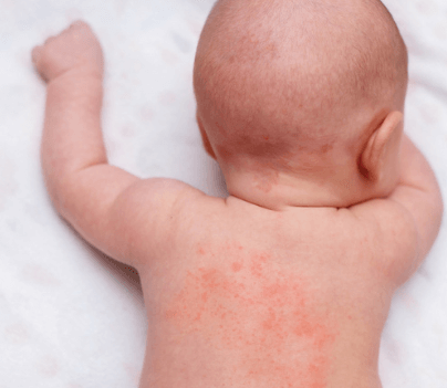 Baby Skin Care: Safe Skincare for Newborns, Babies & Children - What You Need to Know