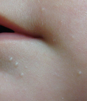 Baby Skin Care: Safe Skincare for Newborns, Babies & Children - What You Need to Know