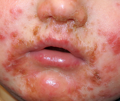 Baby Skin Care: Safe Skincare for Newborns, Babies & Children - What You Need to Know