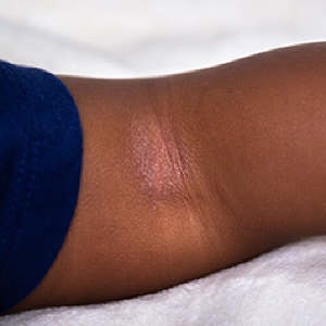 Baby Skin Care: Safe Skincare for Newborns, Babies & Children - What You Need to Know